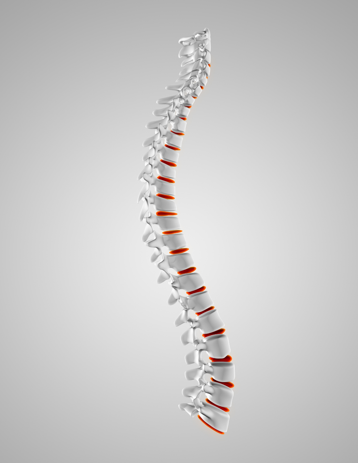 Managing and Reducing Ankylosing Spondylitis Symptoms: A Comprehensive Guide Backed by Scientific Evidence